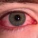 eyes