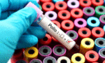 Polio Virus