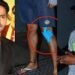 varun dhawan got injured