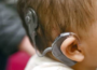 cochlear